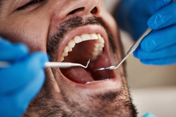 Best Root Canal Emergency Dentist  in Buies Creek, NC