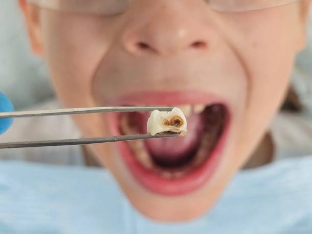 Best Cracked Tooth Emergency Dentist  in Buies Creek, NC